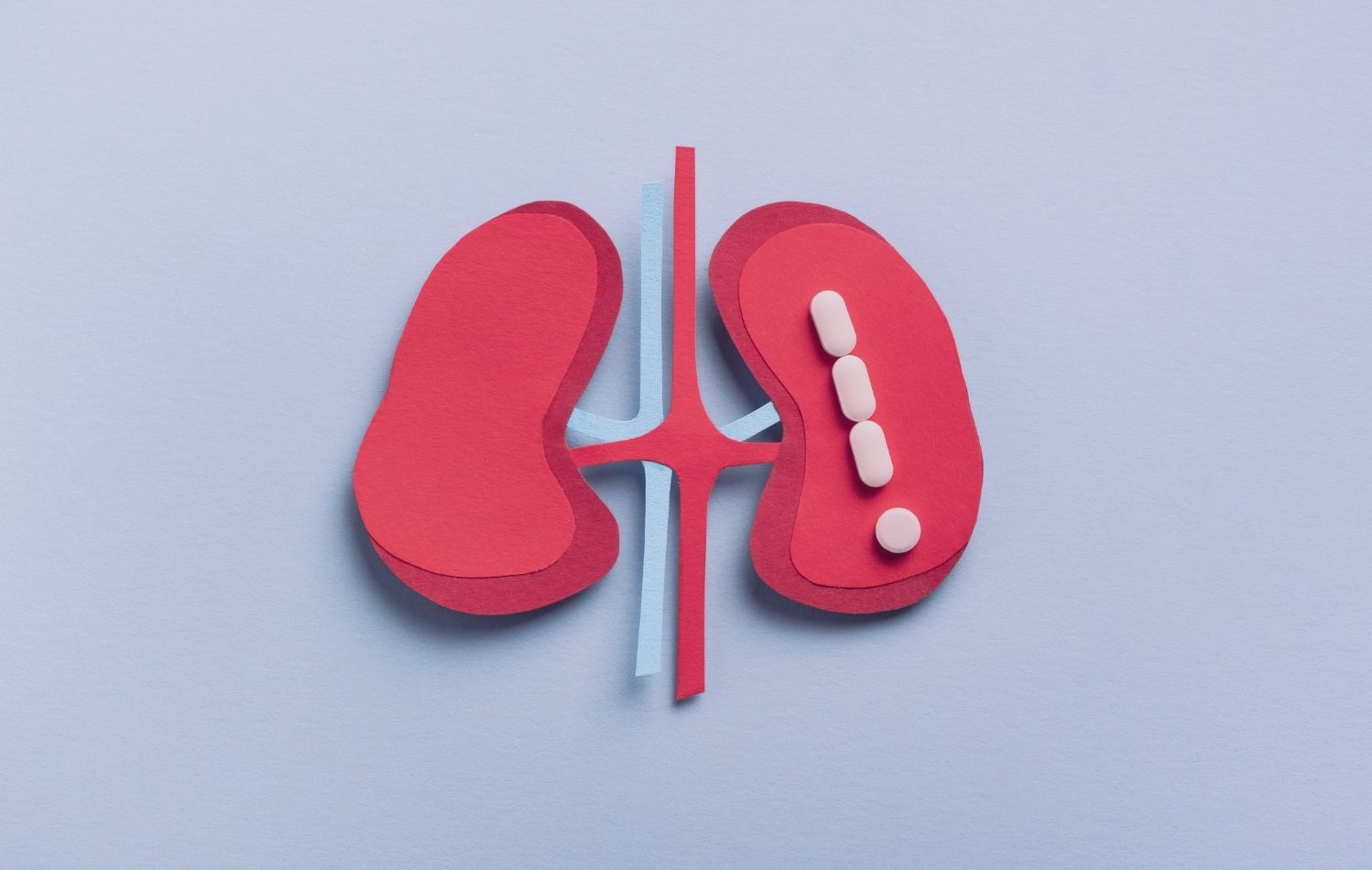 Cálculos renales: causas, síntomas y métodos de tratamiento